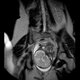 Illustration for article titled Bonus: Stills Of The MRI Live Birth